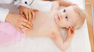 Qué es la circuncisión Copia